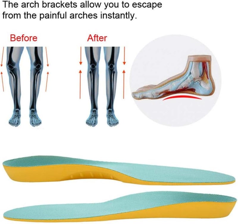 klarako Insoles for Children Breathable Flat Feet Orthopedic Insole Orthotic Corrective Arch Support Cushion Shoe Inserts Insoles Pads for Kids (S) S - Image 2