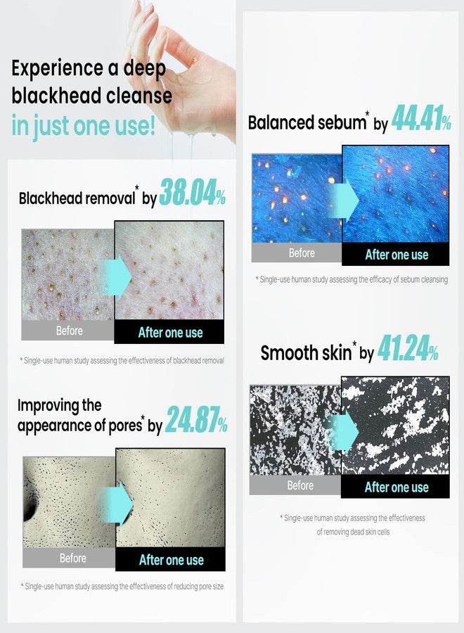 ilso زيت تنظيف سيبوم المذاب الفائق من إيلسو، نوع زيت مائي، غسول وجه للبشرة الحساسة، مزيل مكياج للرؤوس السوداء، العناية بالبشرة الكورية 6.75 أونصة سائلة (200 مل) - Image 4