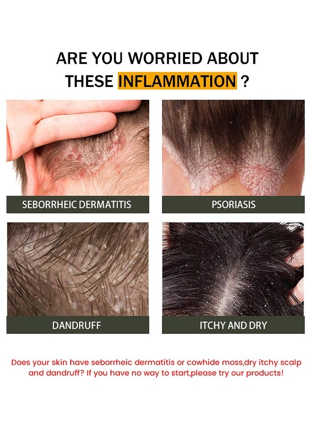 Sumifun Seborrheio Dermatitis Cream - Scalp care cream,cream For Scalp Prone To Folliculitis, Dermatitis, Dandruff, Mites, Itchy And Flaky Scalp, Treats Dandruff And Seborrheic Dermatitis - Image 2