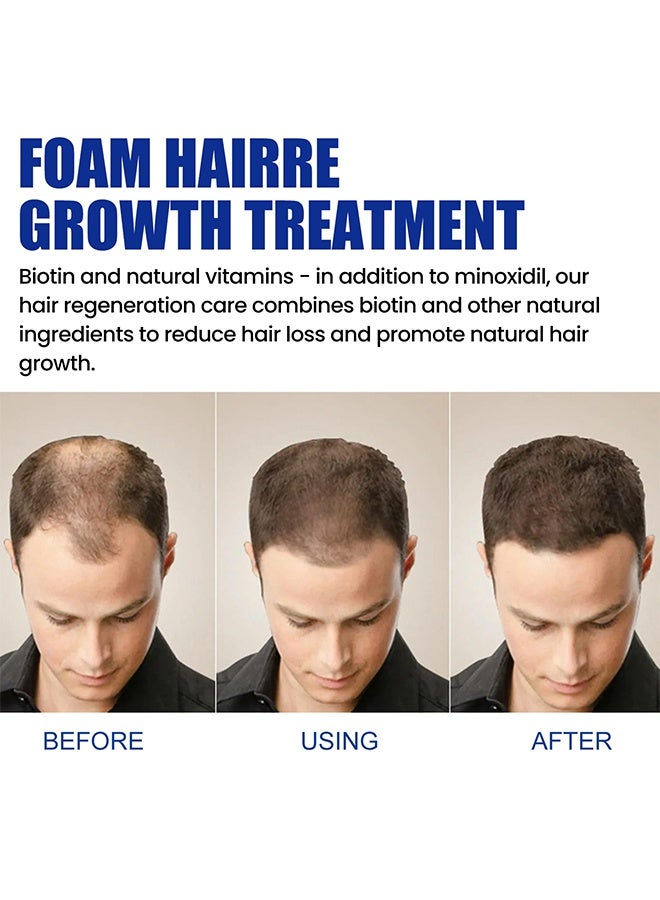 إيست مون رغوة إعادة نمو الشعر المينوكسيديل 5٪ للرجال - مكافحة تساقط الشعر وترققه وانحسار خط الشعر ، وتعزز اللحية والشعر الأكثر كثافة - Image 5
