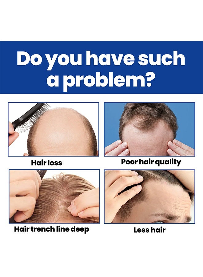 إيست مون رغوة إعادة نمو الشعر المينوكسيديل 5٪ للرجال - مكافحة تساقط الشعر وترققه وانحسار خط الشعر ، وتعزز اللحية والشعر الأكثر كثافة - Image 3