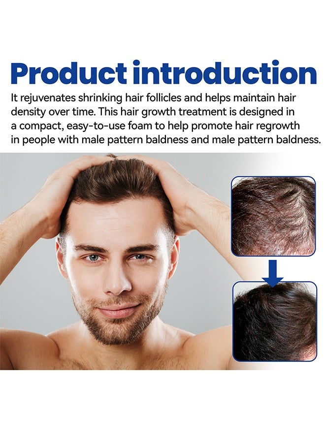 إيست مون رغوة إعادة نمو الشعر المينوكسيديل 5٪ للرجال - مكافحة تساقط الشعر وترققه وانحسار خط الشعر ، وتعزز اللحية والشعر الأكثر كثافة - Image 4