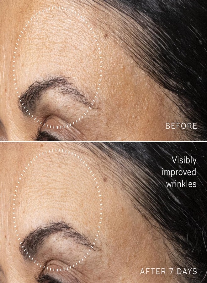 Medik8 ميديك8 سي-تيترا أدفانسد - سيروم فيتامين سي اليومي المتوازن والممتلئ والمرطب مع حمض الهيالورونيك والسكواليين - ينعم الخطوط الدقيقة والتجاعيد - 1.0 أونصة - Image 5