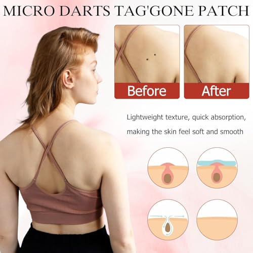 Elvana Pro Micro Darts Tag Gone Skin Patches, Natural Nano Pimple Plasters, Microdart Plasters, Acne Pimple Patches, Micro Pimple Plaster's for All Skin Types (4 Sheet) - Image 4