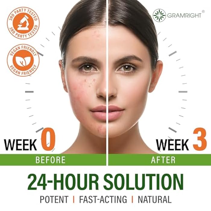 GRAMRIGHT Acne Face Cream - Acne Spot Treatment for Face & Acne Dots - Tea Tree Oil & Salicylic Acid - Natural Cystic Acne Treatment - Made in USA - For All Skin Types - Acne Scar Cream & Pimple Remover 4 fl.oz - Image 3