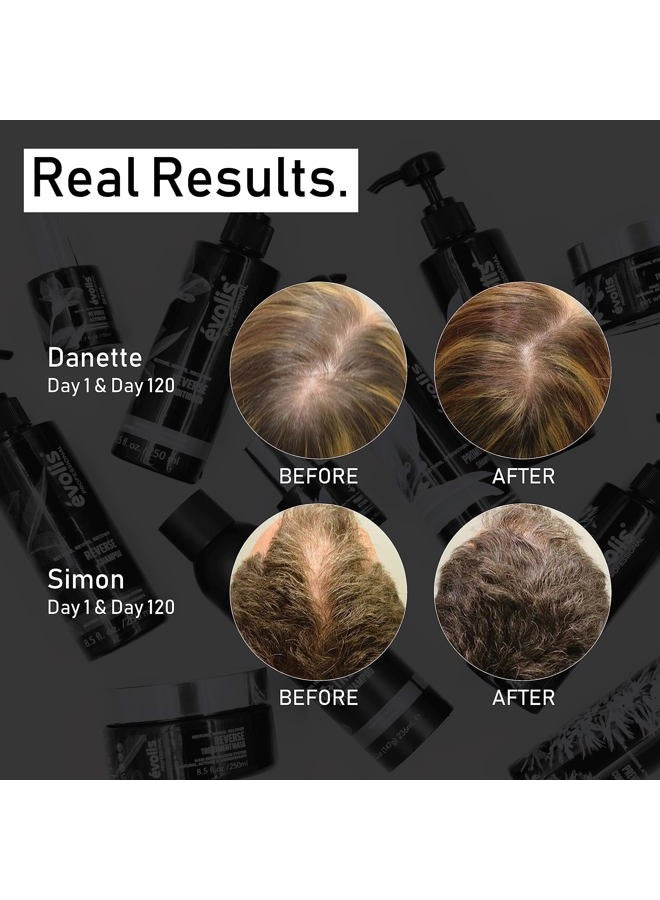 evolis Prevent Anti-Aging Conditioner, Natural Anti Hair Loss Conditioner for Men and Women - Ideal for Sensitive, Dry Scalp and Oily Hair - Preventative Hair Loss Treatment (8.5 fl oz) - Image 3