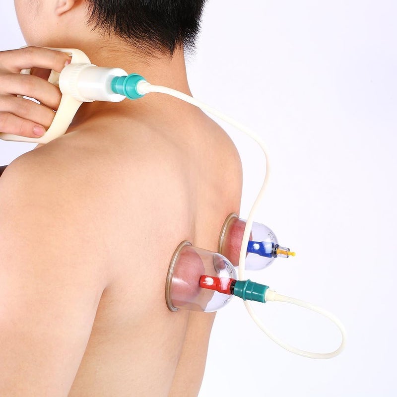 klarako Massage Cupping Set, 32 pcs/Set Cup Vacuum Massage Kit Pain Relief Health Care Vacuum Suction Cupping Set for Body Massage - Image 2