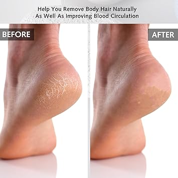 DILUSILK 2 Pcs Pumice Stone for Feet and Hands Foot Scrubber for Dead Hard Skin Removal Natural Foot File and Callus Remover for Exfoliation - Image 5