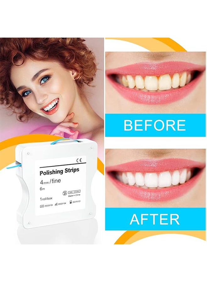 4mm x 6m Dental Polishing Strips, Fine Inter-dental Oral Care Cleaning Tool, Resin Grinding Whitening Teeth Surface - Blue, Fine - Image 3