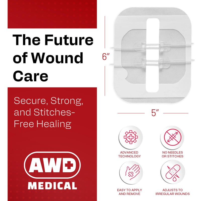 AWD Medical AWD Zip Stitch Wound Closure Strips - 2 Zipstitch Devices, 2 Sterile Gauzes, 2 Alcohol Wipes - Emergency Laceration Device for Cuts Without Stitches - Steri Strips First Aid & Survival - Image 2
