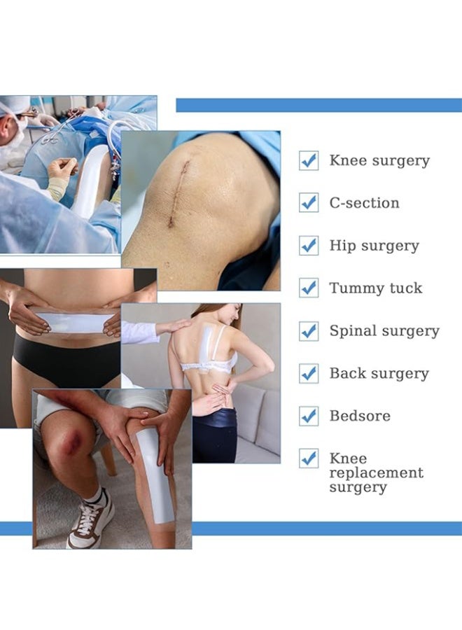5 Pcs Waterproof Surgical Dressings, Transparent Adhesive Bandages for Wound Care, Post-Surgery Incision Protection (Knee, C-Section, Spinal, etc.), Breathable & Elastic Medical Tape, 10*30cm - Image 5