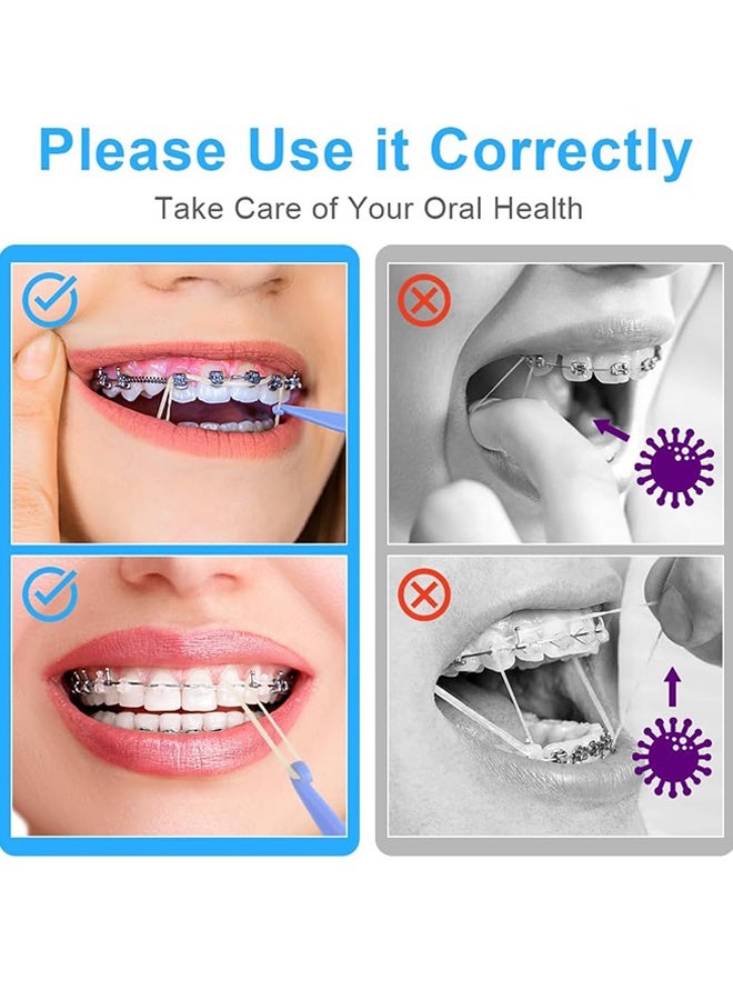 Unique 500 Pcs Orthodontic Elastic Rubber Bands - 3.5 Oz 3/8" Size Heavy Dental Rubber Traction Bands - 5 Rubber Band Positioners for Teeth Gap, Braces, Dog Grooming Top Knots, Bows, Braids, Tooth Gaps, and Dreadlocks（Monkey） - Image 5