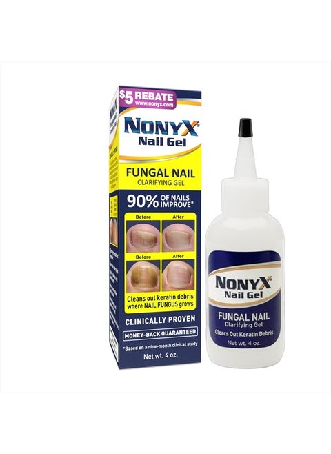 Fungal Nail Clarifying Gel | Rids Nails of Fungus by Removing Keratin Debris Where Nail Fungus Grows | 90% of Toenails Improved Using this Toenail Fungus Treatment | 4 oz