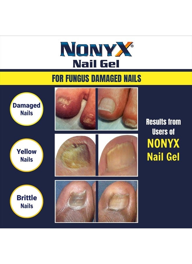 Fungal Nail Clarifying Gel | Rids Nails of Fungus by Removing Keratin Debris Where Nail Fungus Grows | 90% of Toenails Improved Using this Toenail Fungus Treatment | 4 oz