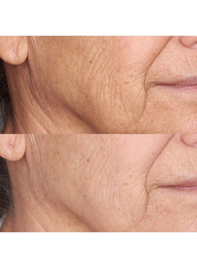 Perricone MD High Potency Face Finishing & Firming Moisturizer Broad Spectrum Spf 30, 2 Fl. Oz. - Image 2