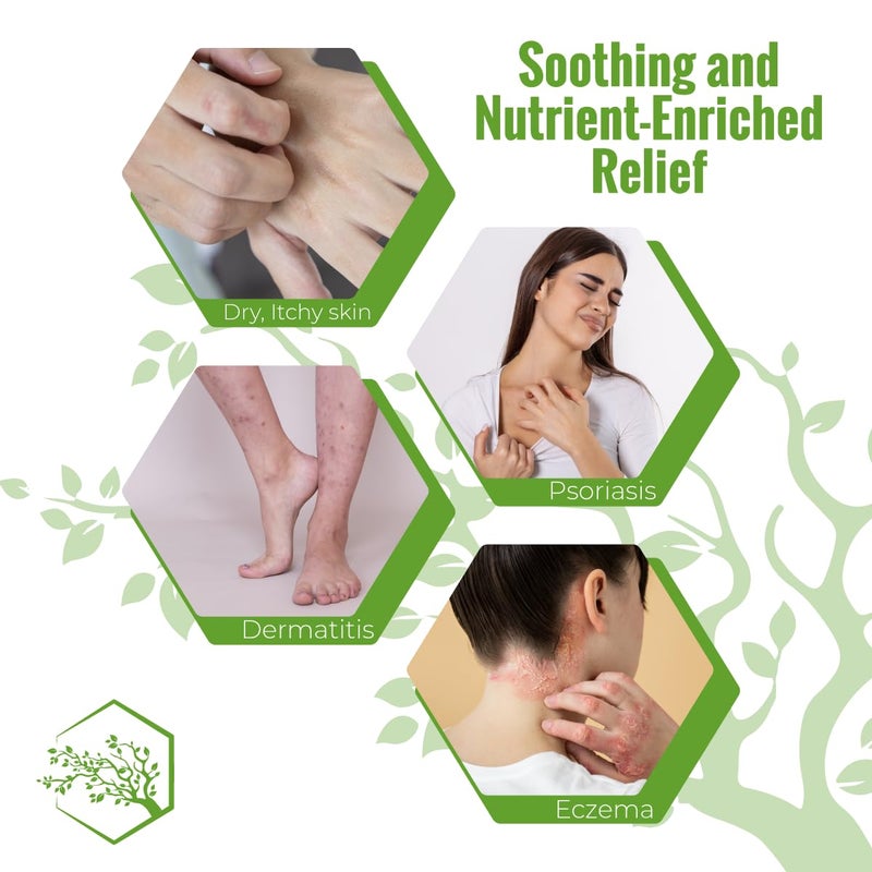 Wild Naturals Moisturizing Eczema Body Wash â€“ Gentle Psoriasis Body Wash for Itchy, Dry Skin Relief â€“ Eczema Soap for Redness and Flareups â€“ Hydrating Cleanser for Women and Men - Image 3