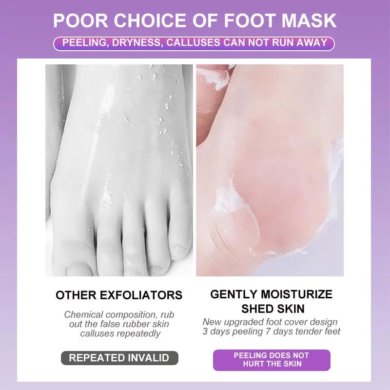 BIRDLINE Foot Peel Mask For Cracked Heels Dead Skin Calluses Remover Make Your Feet Baby Soft Get Smooth Silky Skin Removes Rough Heels Dry Toe Skin Natural Treatment To Home 2 PAIR - Image 5