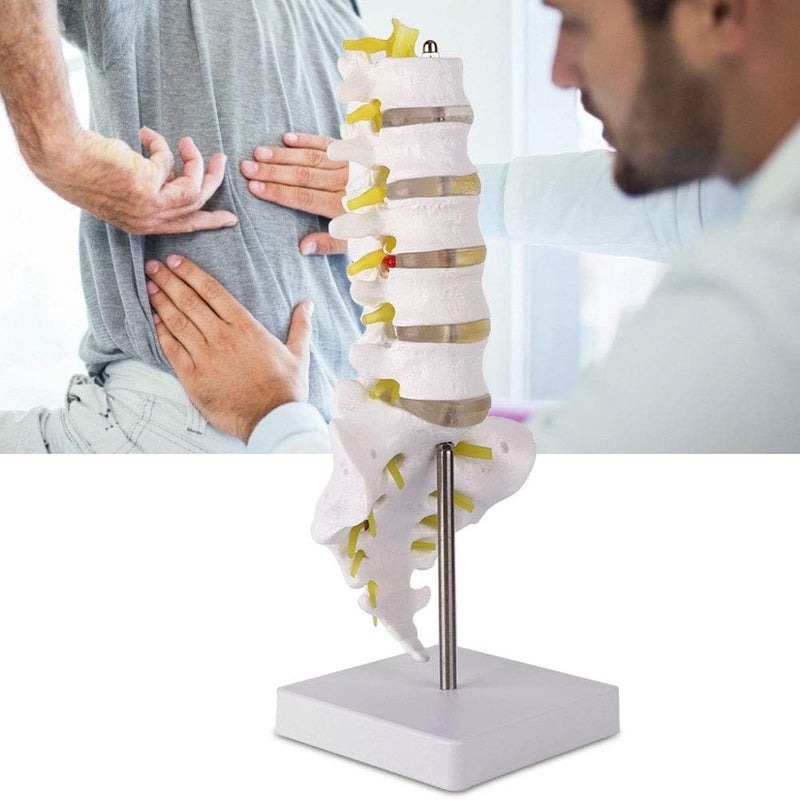 klarako Human Lumbar Model, 1:1 Precise Scale Human Lumbar Spine Model Made of Durable PVC Material Come with Base, Suitable for Teaching - Image 3