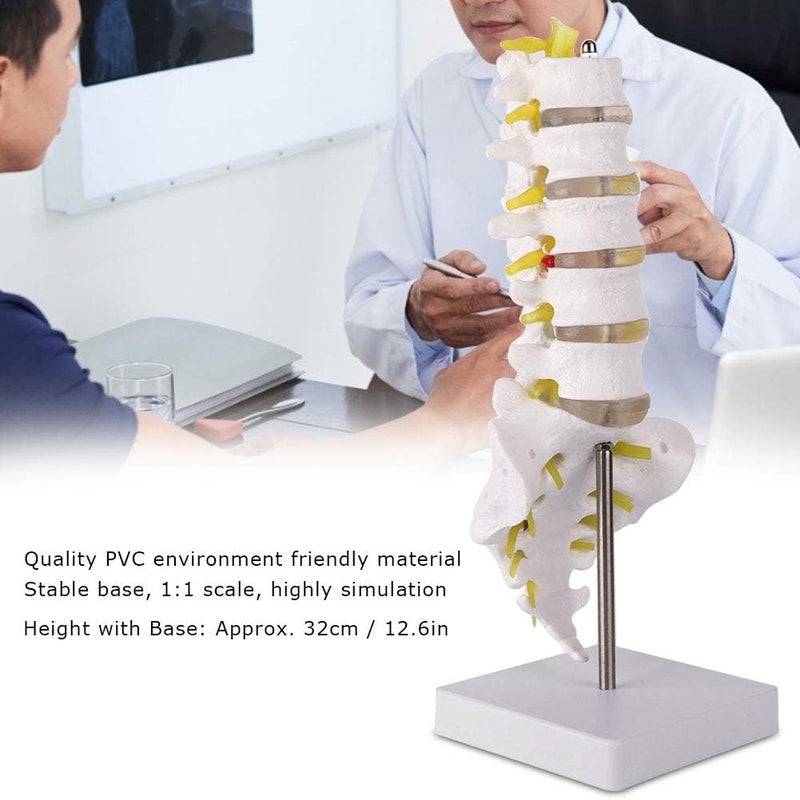 klarako Human Lumbar Model, 1:1 Precise Scale Human Lumbar Spine Model Made of Durable PVC Material Come with Base, Suitable for Teaching - Image 1