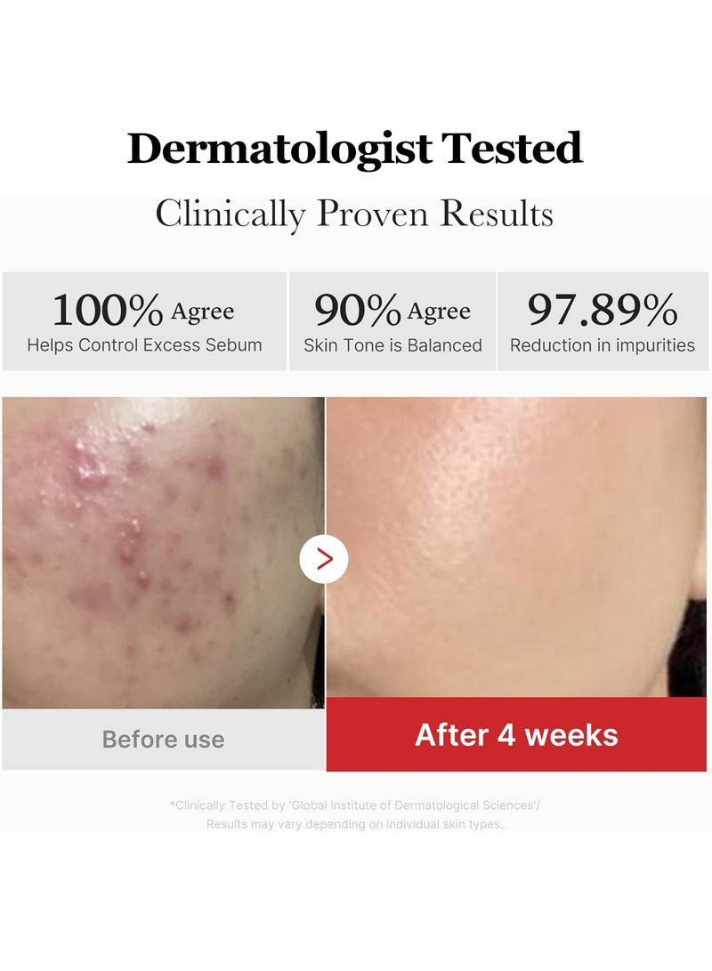 ميديكيوب ضمادات تقشير الوجه ميديكيوب ريد بحمض السكسينيك والبانثينول - ضمادات تونر مقشرة للبشرة المعرضة لحب الشباب مع النياسيناميد وأحماض ألفا هيدروكسي وأحماض بيتا هيدروكسي والبانثينول المهدئ - غير كوميدوغينيك - Image 5