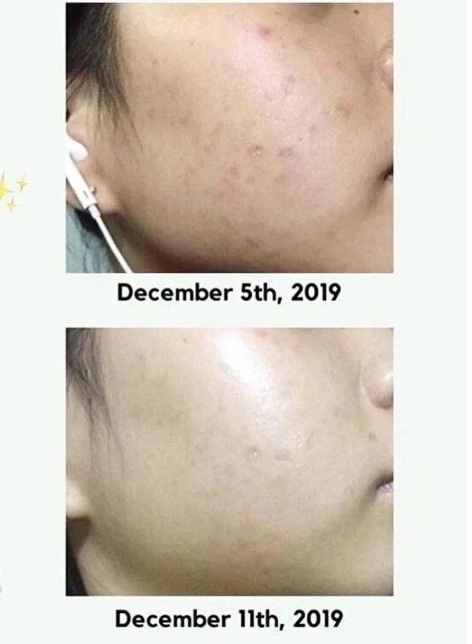 Brightening And Moisturizing Dark Spot Correcting Glow Serum 50ml - Image 3