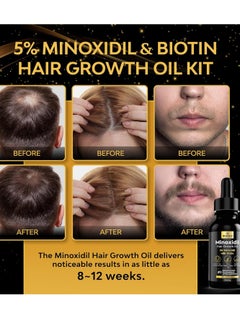 beaueli 5% Minoxidil for Men Hair, Minoxidil for Women Hair Growth, Minoxidil for Men Beard Growth, Minoxidil 5 Percent, Hair Regrowth for Men, Hair Loss Treatments for Women 1oz  - Image 3