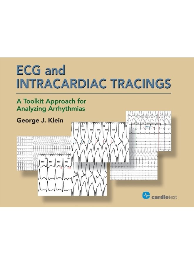 ECG and Intracardiac Tracings A Toolkit Approach for Analyzing Arrhythmias - Paperback