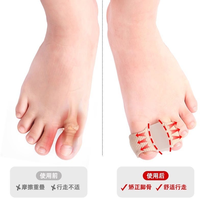 Toe Valgus Corrector, Big Toe And Foot Bone Correction Artifact, Silicone Toe Separator, Men'S And Women'S Foot Shape Correction Artifact - Image 5