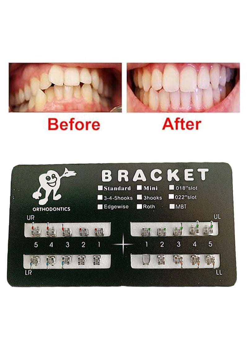 Apustim 2 Sets Of 40 Dental Brackets，Bondable，Unisex，Indoor Use，Dental Health Theme，Wall Mount，Frameless，Stainless Steel （Mini Roth 022 Slot 345 Hook）  - Image 2