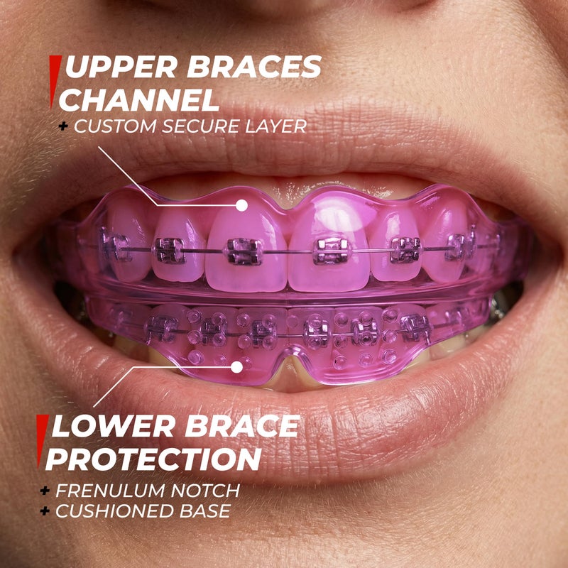 SAFE GRIN Mouth Guard for Sports - Premium Silicone Upper & Lower Teeth Protection - Football, Lacrosse, Hockey, Baseball - Fit for Youth and Teens (Pink, Mouthguard for Braces) - Image 3