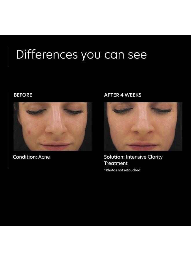 بي سي ايه سكين علاج نقاء مكثف 0.5% فيتامين أ نقي ريتينول و2% مصل حمض الساليسيليك للوجه للبشرة المعرضة لحب الشباب (1 أونصة) - Image 4