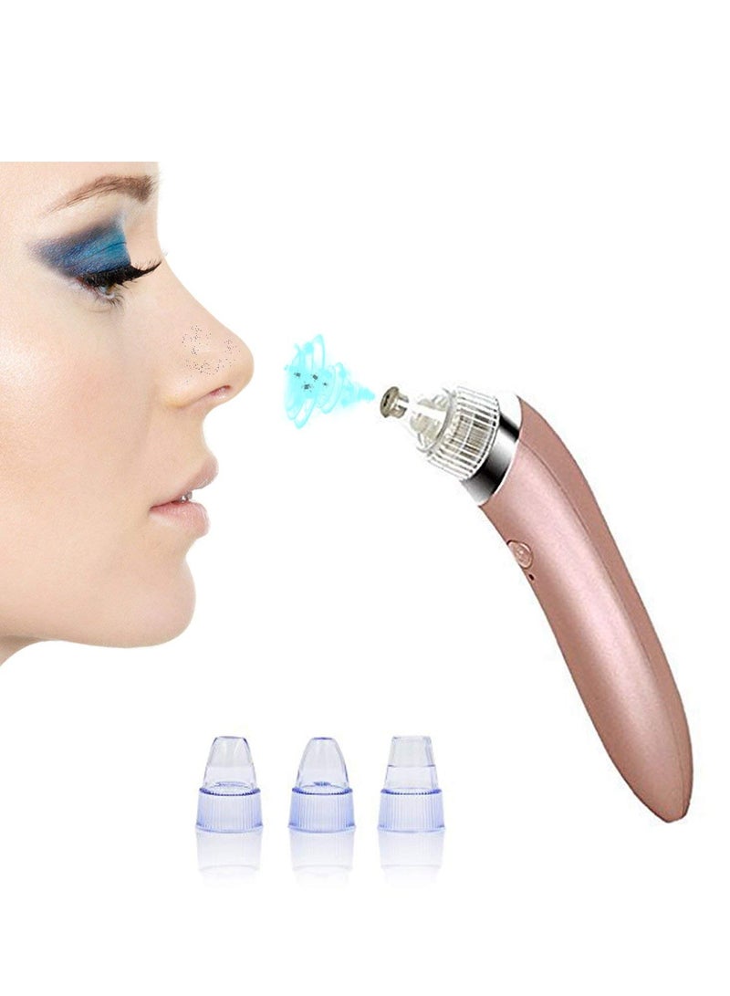 Generic 4 In 1 Blackhead Remover Device - Image 1