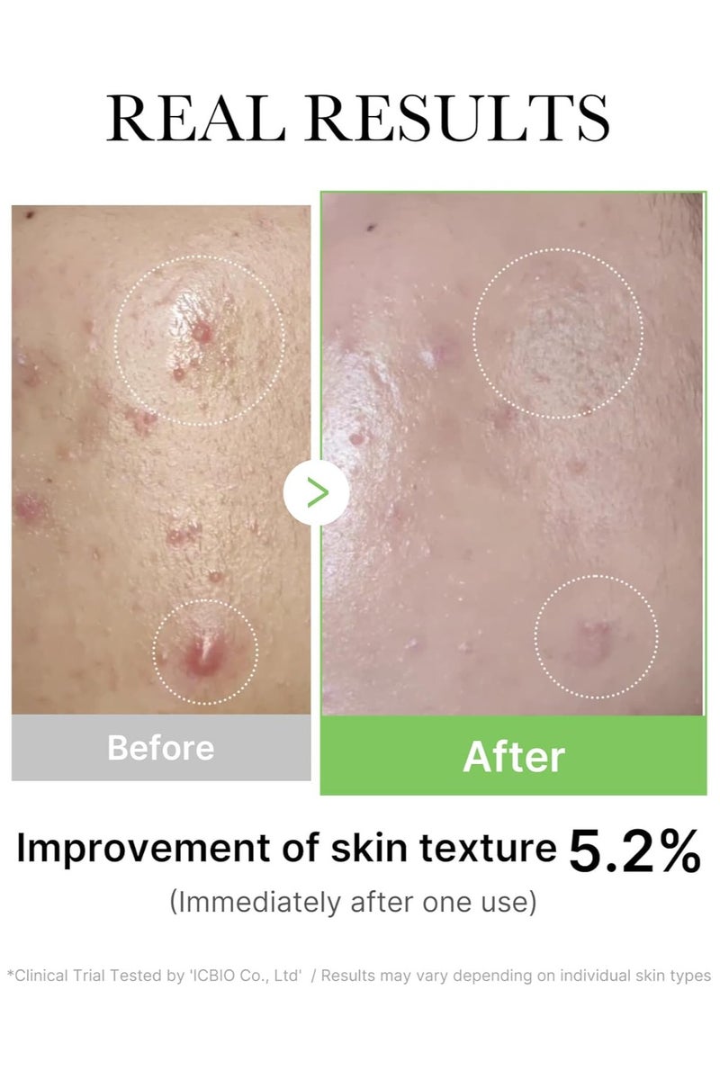 Medicube Exosome Cica Ampoule Serum (30ml) for Sensitive & Acne Prone Skin - Soothing Hydrating Facial Serum with Centella & Tea Tree, Lightweight Fast Absorbing Formula for Calming Redness & Strengthening Skin Barrier - Image 5