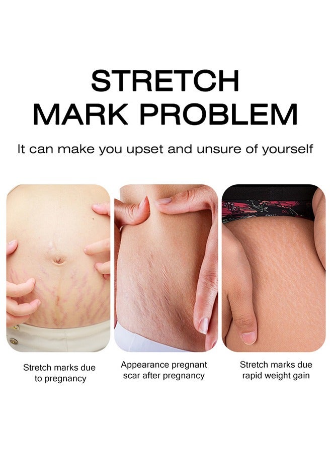 OEDO Rose Remove Stretch Marks Cream， Natural Plant Essence Formula Maternity Skin Treatmentpregnancy Scarsrepair Cream 40g - Image 3