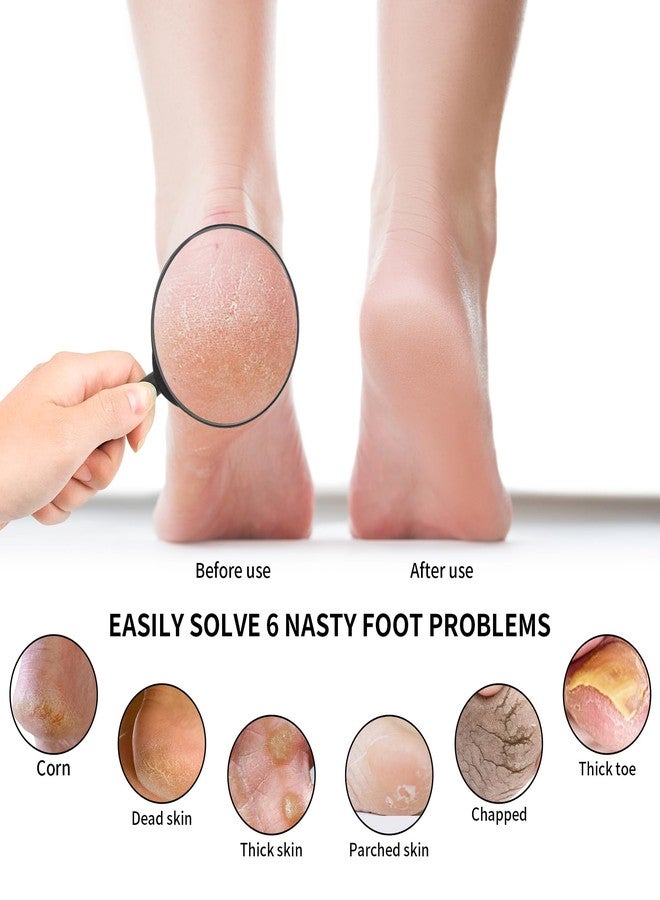 KIRA Foot File Wooden Handle Foot Scrubber Double Sided Foot File Callus Remover Professional Foot Rasp Heel Scraper for Wet or Dry Skin Easy to Clean Pedicure Tool - Image 3