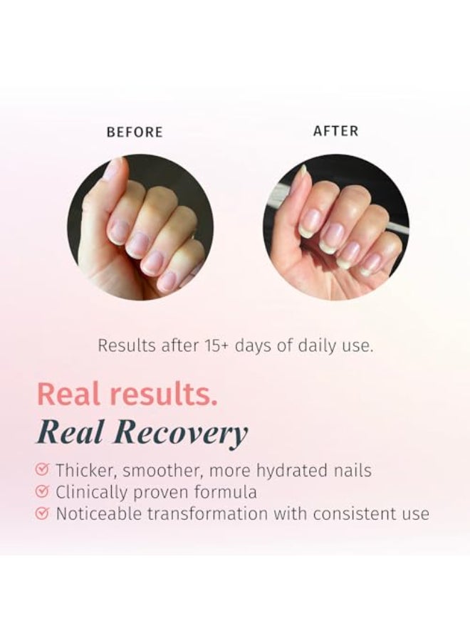 duri Rejuvacote 1 Original Maximum Strength Nail Growth System Base Top Coat Nails Hardening Repair Chipping Strengthen Breaking and Brittle Treatment by Duri cosmetics Pack of 1 - Image 4