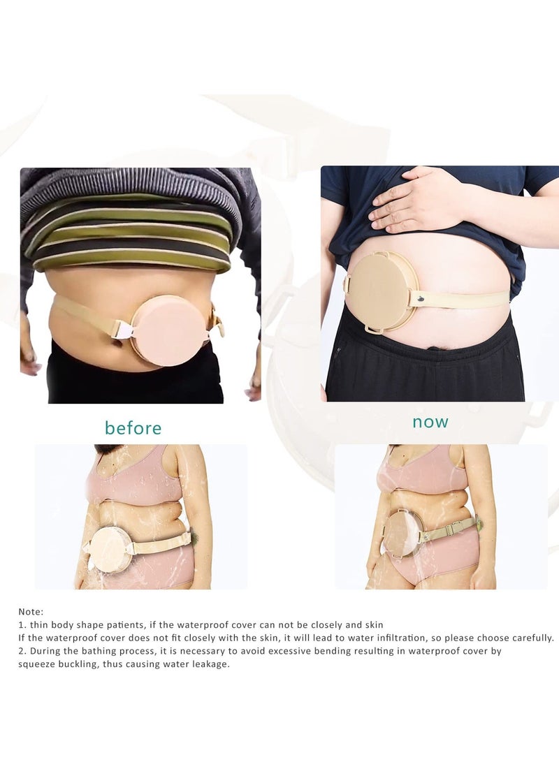Y&D Ostomy Shower Wound Protector, Stoma Waterproof Bath Cover Adjustable Belt Supply, Skin Color(1 pcs)  - Image 5