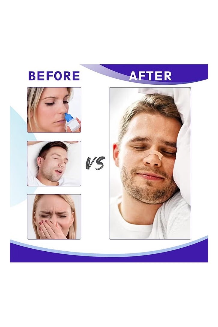 EzyCare Nasal Strips for Snoring, 10 Pcs Nose Strips for Breathing Sleeping Help Stop Snoring Relieve Nasal Congestion Nasal Strips Snoring Devices for Men Women Anti Snore Strips - Image 2