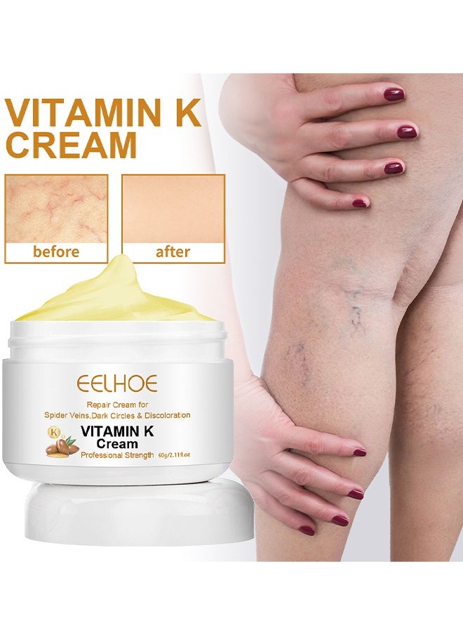 EELHOE - Vitamin K Varicose Veins Cream, Soothing Leg Cream, Varicose And Spider Veins Treatment Cream, Improve Blood Circulation, Fast Relieve Swelling Pain 60G - Image 1