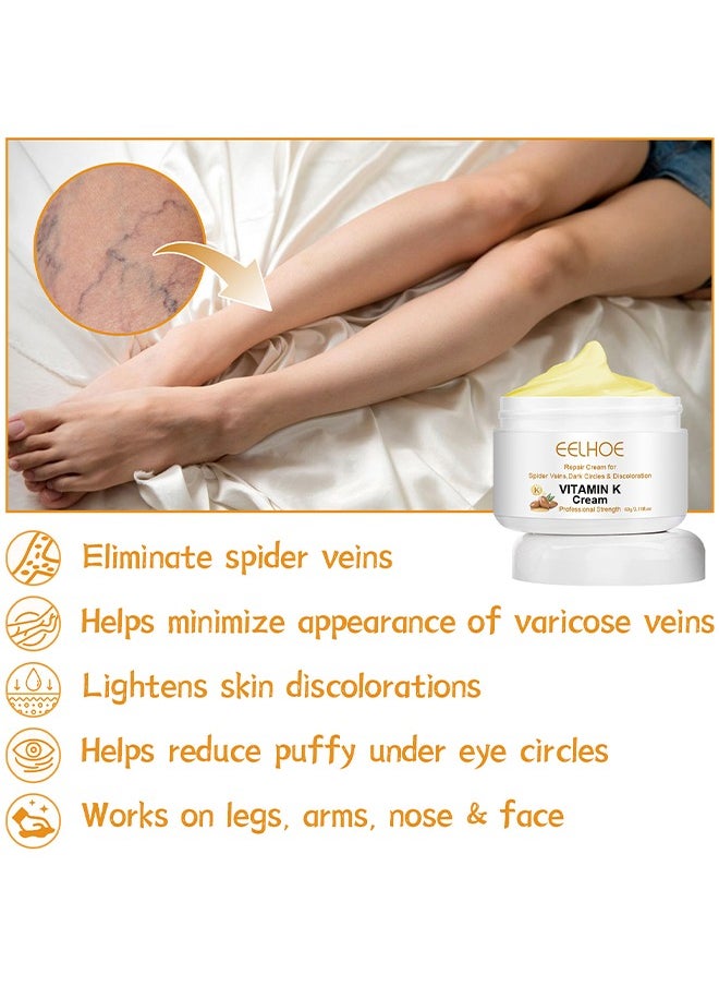 EELHOE - Vitamin K Varicose Veins Cream, Soothing Leg Cream, Varicose And Spider Veins Treatment Cream, Improve Blood Circulation, Fast Relieve Swelling Pain 60G - Image 1