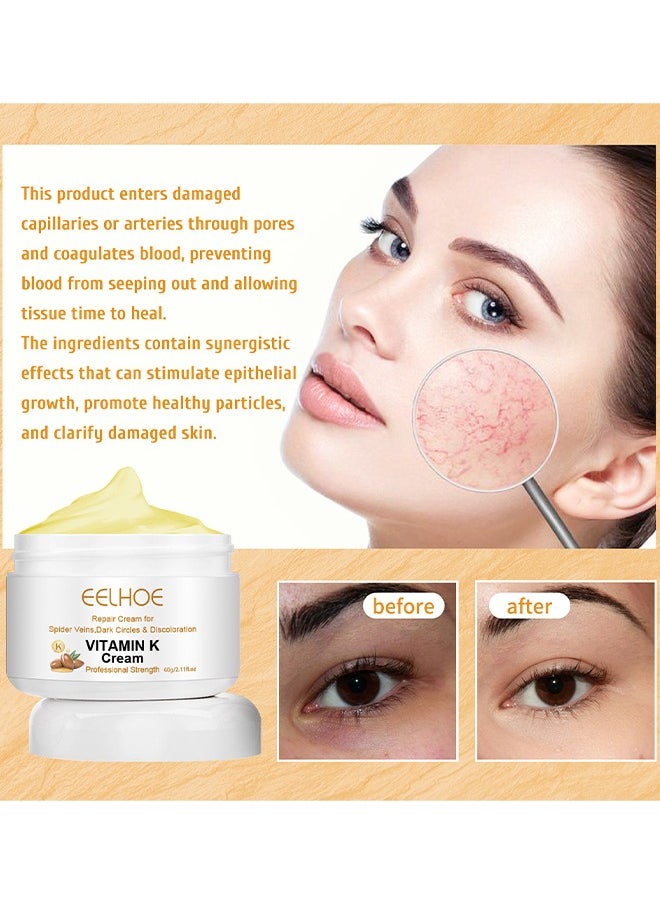 EELHOE - Vitamin K Varicose Veins Cream, Soothing Leg Cream, Varicose And Spider Veins Treatment Cream, Improve Blood Circulation, Fast Relieve Swelling Pain 60G - Image 1