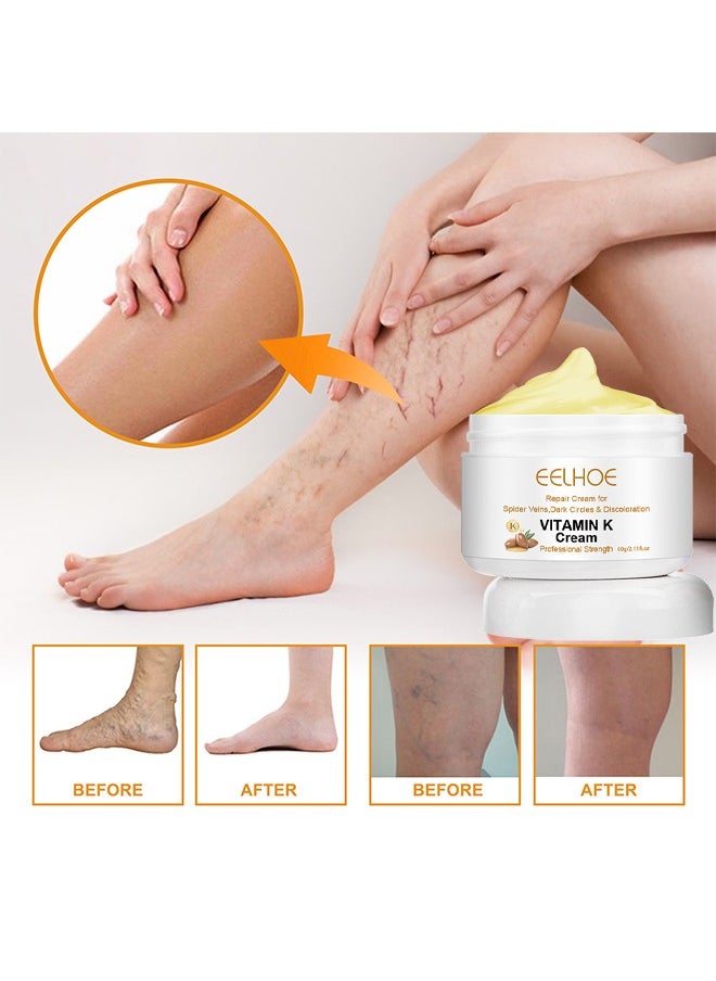 EELHOE - Vitamin K Varicose Veins Cream, Soothing Leg Cream, Varicose And Spider Veins Treatment Cream, Improve Blood Circulation, Fast Relieve Swelling Pain 60G - Image 1