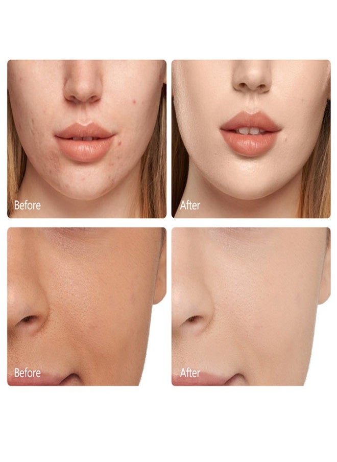 GUANJING - Kojic Acid Essence Toner For Face And Body,Effectively Replenish Nutrients Improve Dryness Soften Cuticles Minimize Poreslighten Acne Scars Soothe And Repair Skin - Image 1