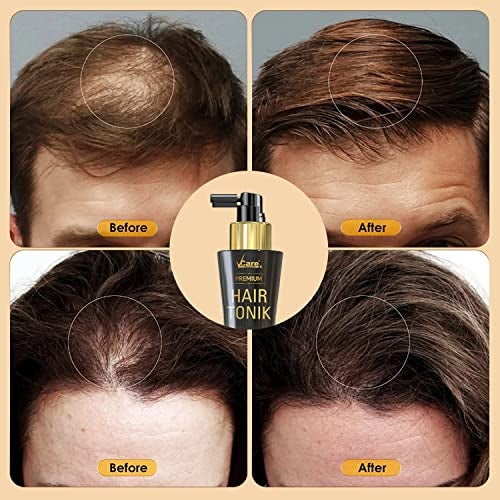 VCare Day Night Hair Tonic For Men & Women with Castor Oil and Olive Leaf Extract-Best Scalp Serum for All Hair Type-Prevents Hair Fall & Strengthens Hair Stimulates (100ml Pack of 1) - Image 3