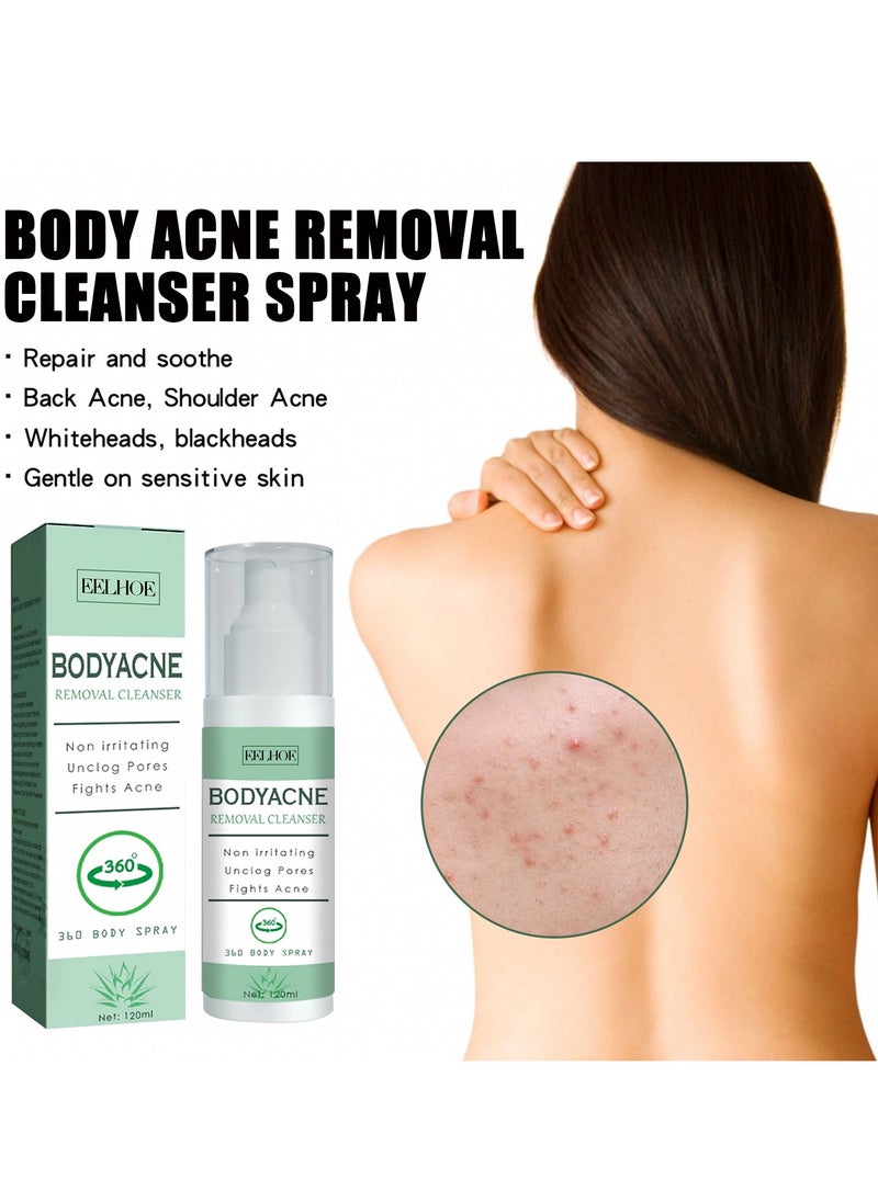 EELHOE Body Acne Removal Cleanser Spray, Back Acne Treatment, Back Acne Spray, Body Acne Marks Repair Back Shoulder Acne Skin Care Spray,120ml  - Image 1