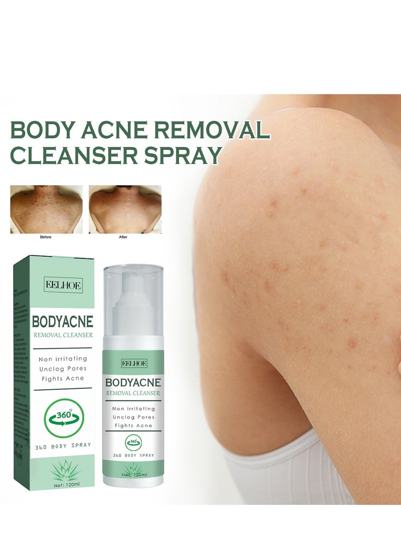 EELHOE Body Acne Removal Cleanser Spray, Back Acne Treatment, Back Acne Spray, Body Acne Marks Repair Back Shoulder Acne Skin Care Spray,120ml  - Image 2