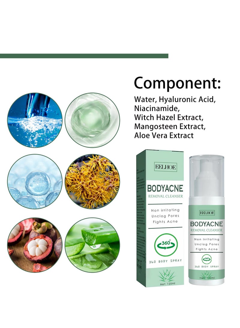 EELHOE Body Acne Removal Cleanser Spray, Back Acne Treatment, Back Acne Spray, Body Acne Marks Repair Back Shoulder Acne Skin Care Spray,120ml  - Image 4