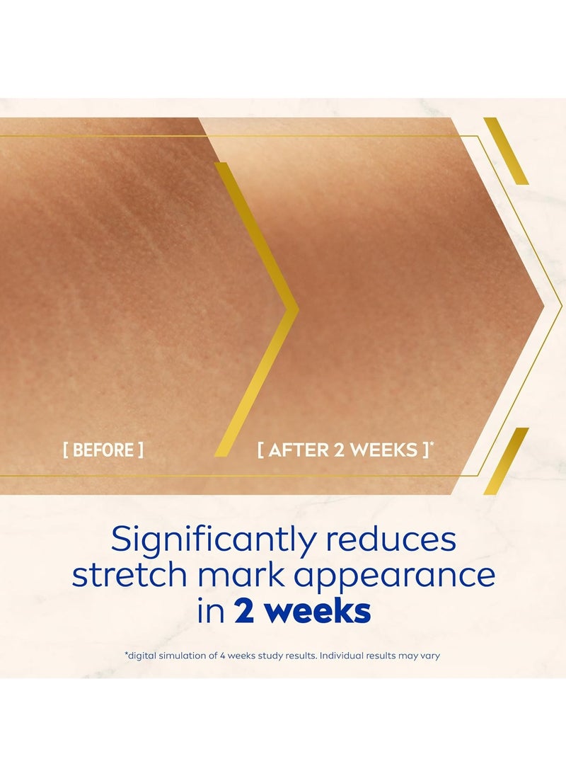 NIVEA LUMINOUS 630 Stretch Marks Reduction Body Oil-Serum, Even Skin Tone, Reduces Visibility of Stretch Marks, Visible Results in 2 Weeks, 48H Moisture, Clinically Proven, for All Skin Types, 100ml
