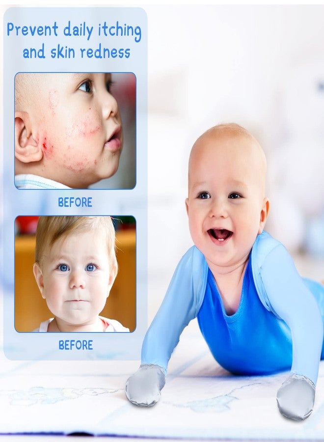 سوريو قفازات Sureio للأطفال الرضع (قطعتان) لعلاج الأكزيما، أكمام واقية من الخدوش، قفازات ثابتة، ملابس أطفال رضع (للأطفال الصغار من عمر 18 شهرًا) - Image 2