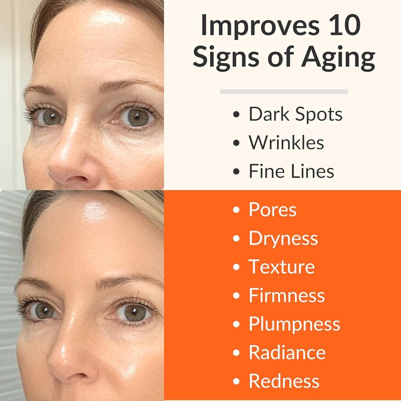 Levaye Vitamin C Serum Anti Aging Facial Serum with Vitamin C ferulic acid Hyaluronic Acid Vitamin E Brightening Serum Targets Dark Spots Fine Lines Wrinkles Dry Skin Firmness 17 Fl Oz - Image 3